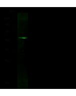 Recombinant Anti-GFAP Antibody, Rabbit Monoclonal sinobiological 100140-R012