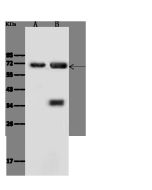 Anti-Annexin VI/ANXA6 Antibody, Rabbit Polyclonal sinobiological 106449-T32