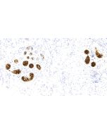 Anti-Human Mammaglobin Antibody, Mouse MAb sinobiological IHC047