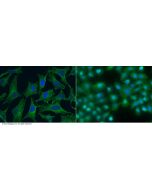 Anti-SPARCL1 Antibody, Mouse Monoclonal sinobiological 10046-MM05
