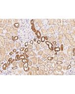 Anti-COBLL1 Antibody, Rabbit Polyclonal sinobiological 203727-T08