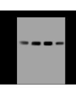 Anti-EEF2K Antibody, Rabbit Polyclonal sinobiological 207341-T36