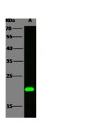 Anti-BID Antibody, Rabbit Polyclonal sinobiological 10468-RP02