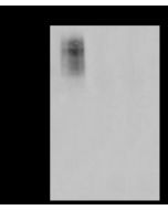 Anti-EGFR Antibody, Rabbit Polyclonal sinobiological 110976-T32