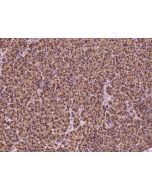 Anti-HEATR4 Antibody, Rabbit Polyclonal sinobiological 206800-T08