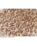 Recombinant Anti-Alkaline Phosphatase/ALPL Antibody, Rabbit Monoclonal sinobiological 100356-R034