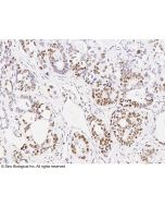 Recombinant Anti-MSH6 Antibody, Rabbit Monoclonal sinobiological 100973-R035