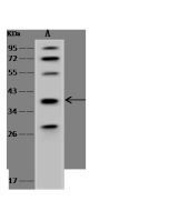Anti-Glycophorin A Antibody, Rabbit Polyclonal sinobiological 204316-T40