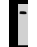 Anti-CNDP1 Antibody, Rabbit Polyclonal sinobiological 50959-T52