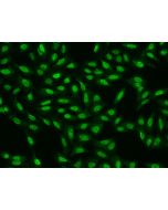 Anti-CDC26 Antibody, Rabbit Polyclonal sinobiological 201338-T02