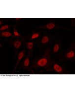 Anti-KAT1/HAT1 Antibody, Rabbit Polyclonal sinobiological 100928-T34