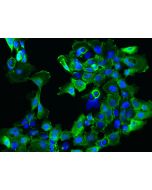 Anti-C1orf116 Antibody, Rabbit Polyclonal sinobiological 202447-T10