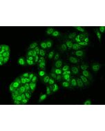 Anti-ERRα/ESRRA Antibody, Rabbit Polyclonal sinobiological 207497-T02