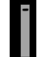 Anti-ADD3 Antibody, Rabbit Polyclonal sinobiological 202303-T38
