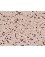 Anti-CAPRIN1 Antibody, Rabbit Polyclonal sinobiological 204396-T10