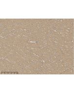 Anti-GAP-43 Antibody, Rabbit Polyclonal sinobiological 204154-T10