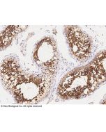 Anti-ART3 Antibody, Rabbit Polyclonal sinobiological 13542-T24