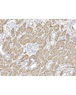 Anti-ASS1 Antibody, Rabbit Polyclonal sinobiological 200448-T08