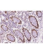 Anti-CDX1 Antibody, Rabbit Polyclonal sinobiological 204876-T08