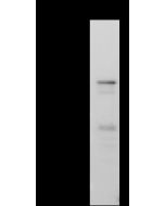 SARS-CoV-2 Nucleocapsid Antibody, Mouse MAb sinobiological 68097-MM184