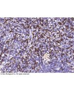 Recombinant Anti-CD8 alpha Antibody, Rabbit Monoclonal sinobiological 10980-R081