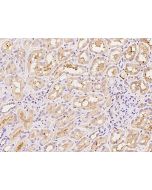 Anti-FABP3/H-FABP Antibody, Rabbit Polyclonal sinobiological 200218-T08