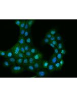 Anti-DLK2 Antibody, Rabbit Polyclonal sinobiological 201960-T02