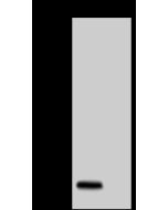 Monkeypox Virus (MPXV) A29 Antibody, Mouse MAb sinobiological 40891-M0031