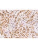 Anti-HOXB9 Antibody, Rabbit Polyclonal sinobiological 206673-T08