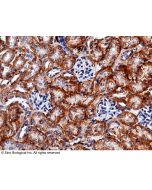 Recombinant Anti-carbonic anhydrase XII/CA12 Antibody, Rabbit Monoclonal sinobiological 50014-R012