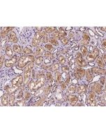 Anti-CNNM3 Antibody, Rabbit Polyclonal sinobiological 200699-T10