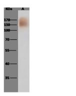 Human coronavirus (HCoV-HKU1) Spike Antibody, Rabbit PAb, Antigen Affinity Purified sinobiological 40021-T62