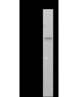 SARS-CoV-2 Nucleocapsid Antibody, Mouse MAb sinobiological 68097-MM182