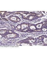 Anti-MAP2 Antibody, Rabbit Polyclonal sinobiological 100568-T08