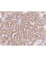 Anti-FLT3 Antibody, Rabbit Polyclonal sinobiological 310683-T08