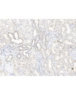 Anti-HIGD2A Antibody, Rabbit Polyclonal sinobiological 204904-T10