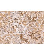 Anti-NAV1 Antibody, Rabbit Polyclonal sinobiological 206789-T08