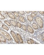 Anti-GOLPH2/GOLM1 Antibody, Rabbit Polyclonal sinobiological 310896-T10