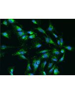 Anti-COA6/C1orf31 Antibody, Rabbit Polyclonal sinobiological 205806-T02