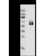 Chikungunya virus (CHIKV) (strain SL-CK1) E2 / Envelope 2 Antibody, Mouse MAb sinobiological 40440-MM32
