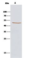 Anti-kynureninase/KYNU Antibody, Rabbit Polyclonal sinobiological 10841-T52