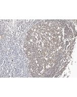 Anti-CD19 Antibody, Rabbit Polyclonal sinobiological 11880-T26