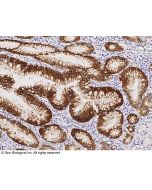 Anti-ALDH3A1 Antibody, Rabbit Polyclonal sinobiological 12523-T60