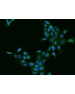 Anti-Cathepsin Z/CTSZ Antibody, Rabbit Polyclonal sinobiological 201244-T02