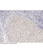 Anti-HGF Antibody, Rabbit Polyclonal sinobiological 10463-RP02