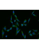 Anti-Adenylosuccinate Lyase Antibody, Mouse Monoclonal sinobiological 11287-MM05T