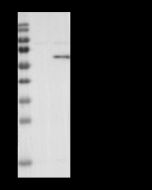 Phospho-Akt (Thr308) Antibody, Rabbit MAb sinobiological 110547-R0002