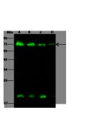 Anti-methionyl aminopeptidase 2/METAP2 Antibody, Rabbit Polyclonal sinobiological 10245-T60