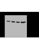 Anti-EIF3E Antibody, Rabbit Polyclonal sinobiological 202557-T36
