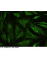 Recombinant Anti-BACE1 Antibody, Rabbit Monoclonal sinobiological 10064-R027